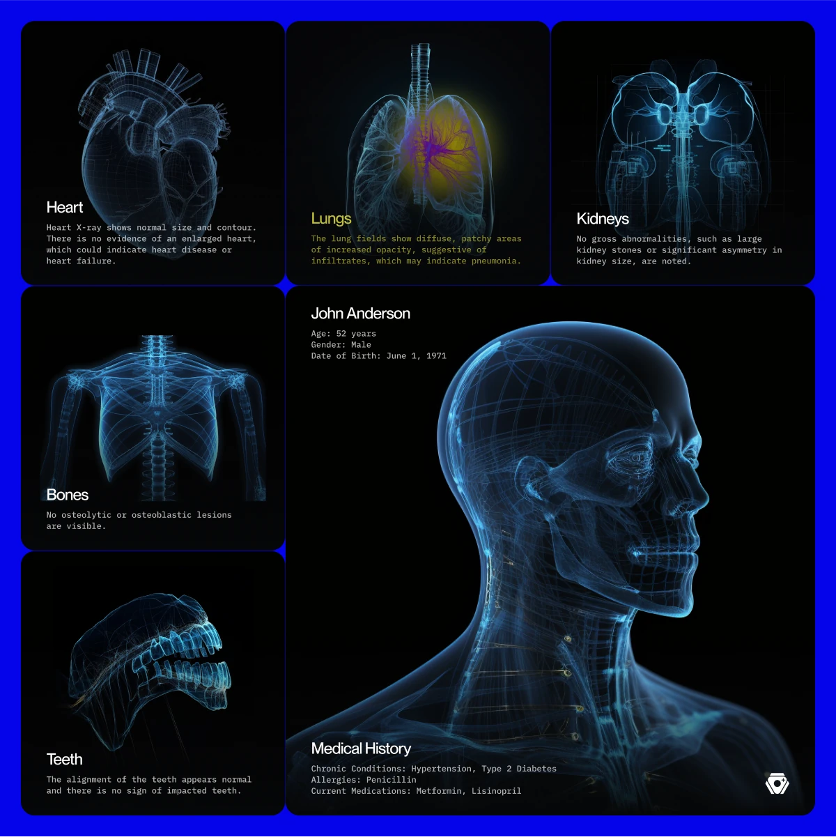 Beyond Surgical patient cards in x-ray blue: heart, lungs, kidneys, bones, teeth and a head