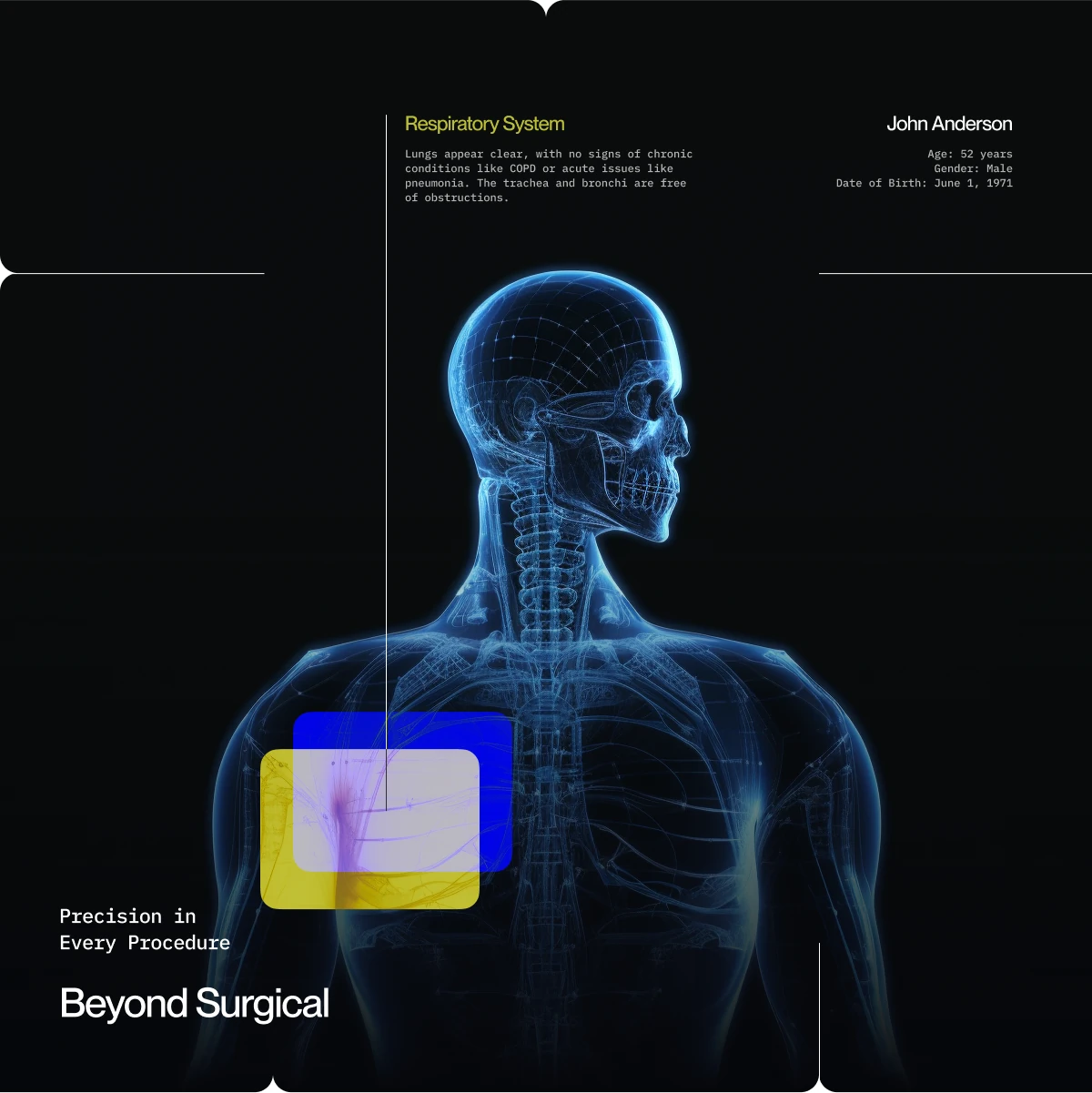 Beyond Surgical patient scan: a blue x-ray torso with a highlighted chest area